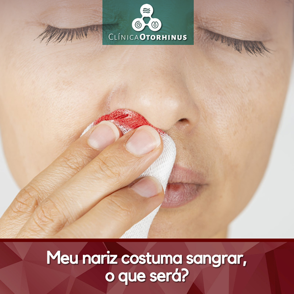 titulo postagem