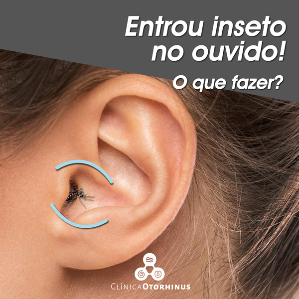 titulo postagem