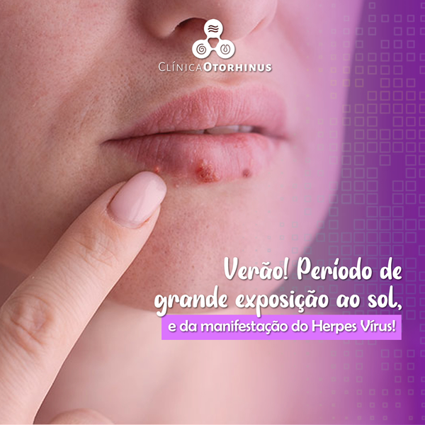 titulo postagem