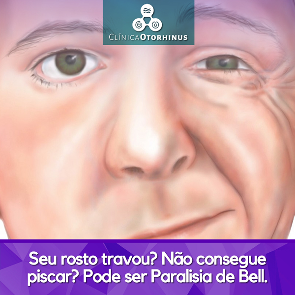 titulo postagem