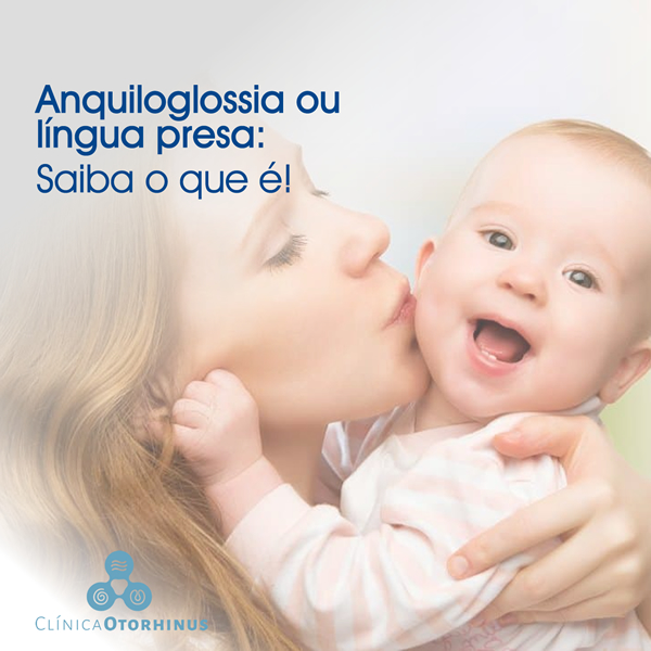 titulo postagem