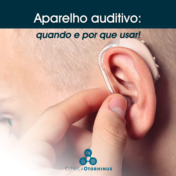 titulo postagem