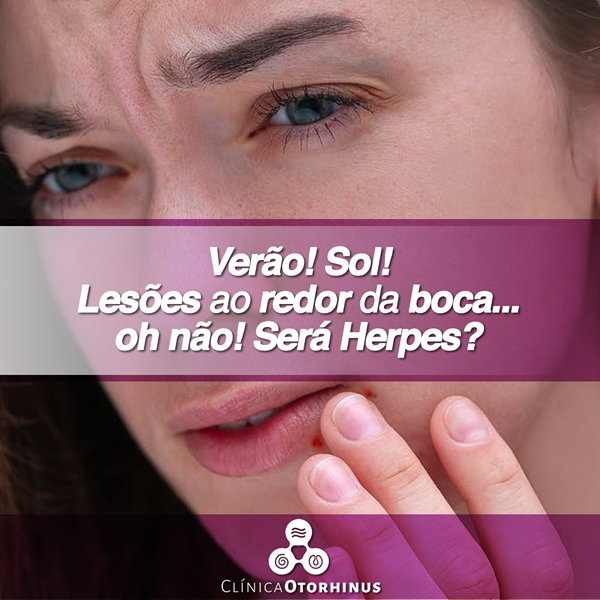 titulo postagem
